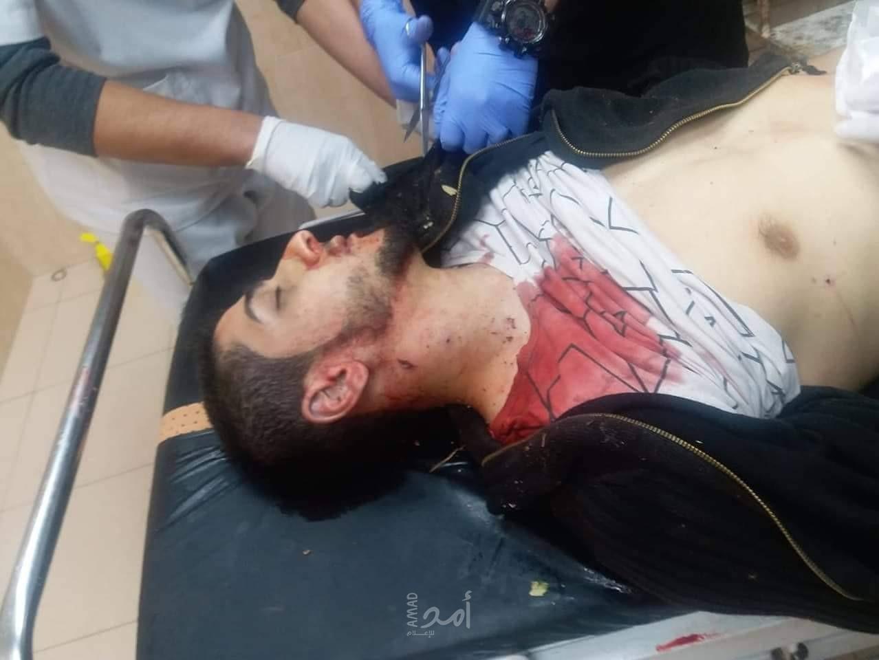 محدث 4- الصحة: (10) شهداء بينهم "طفلة وامرأة حامل" و93 جريحاً في التصعيد الإسرائيلي على غزة