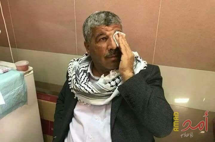 جنود الاحتلال يعتدون على الوزير "وليد عساف" (صور)
