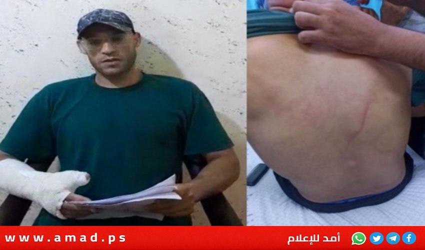 عائلة منصور تصدر بيان حول اعتداء ميلشيا حماس على إبنها يحيى داخل مسجد برفح