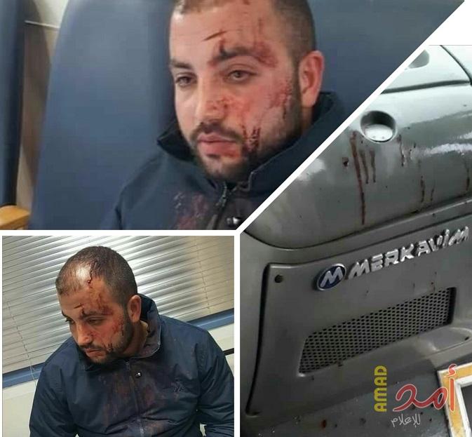 مستوطنو "كريات أربع" يعتدون على شاب من الخليل ويصيبونه بجراح
