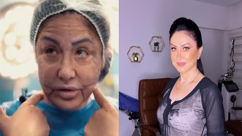 وفاء سالم لـ"جمهورها": أنا عايزة ملامحي زي ما كانت - فيديو