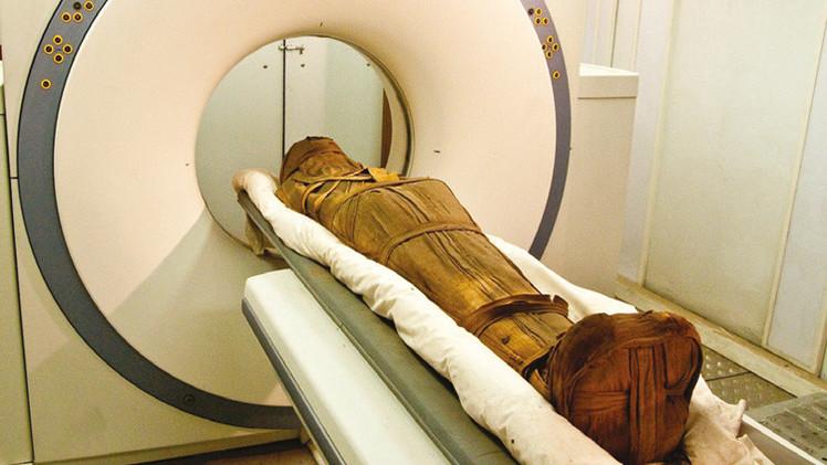من أرض الفراعنة.. اكتشاف أقدم حالة معروفة للإصابة بسرطان الثدي