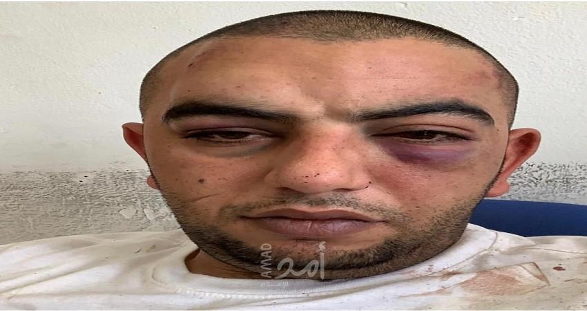 الإفراج عن الشاب "أحمد فراح" بكفالة مالية وإبعاده 15 يومًا عن حي الشيخ جراح