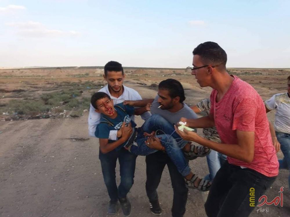 إصابة شاب برصاص قوات الاحتلال شرق مخيم البريج
