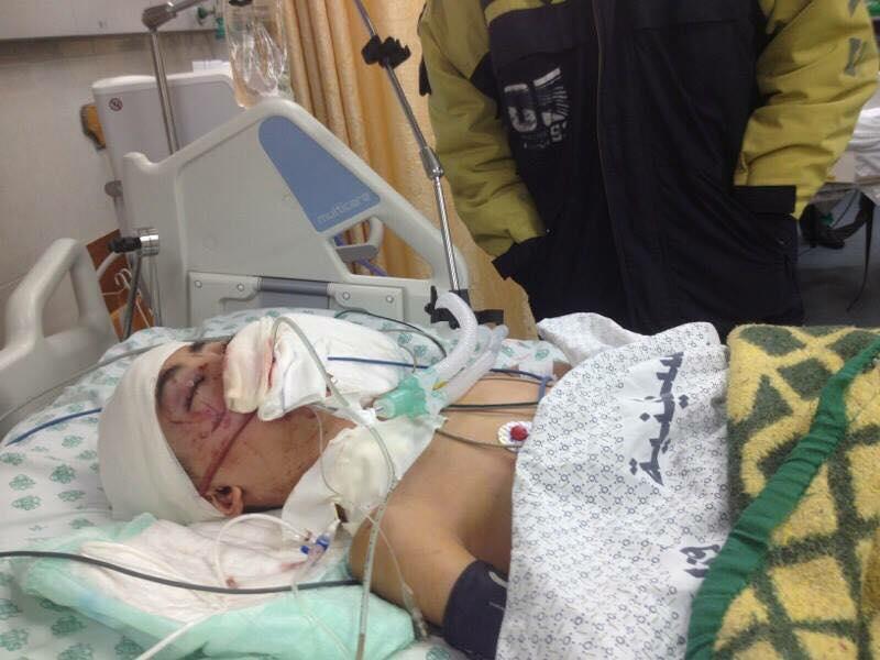 جرحى غزة عين على ألم الإصابة وأخري تراقب فتح المعابر