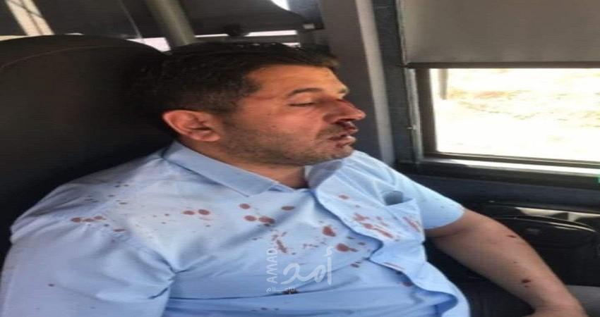 القدس: إصابة سائق حافلة مقدسي بجروح جراء اعتداء مستوطن عليه