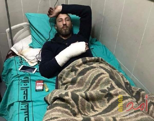 بالصور.. اصابة شاب بكسور جراء رشق المستوطنين سيارته بالحجارة