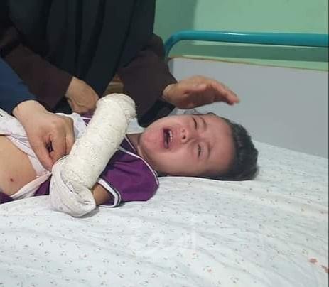 إصابات وأضرار بالمنازل نتيجة قصف طائرات الاحتلال أهداف في قطاع غزة - فيديو وصور