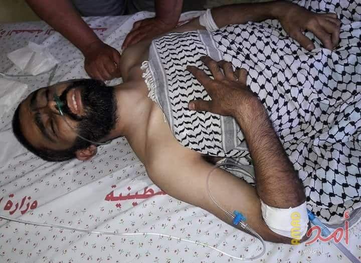 الشهيد الـ 60 لـ#مليونية_ العودة.. استشهاد عمر أبو فول متأثراً بإصابته شرق غزة