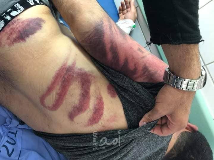 بالصور.. مجهولون يعتدون بالضرب على المحامي "يوسف محسن" أثناء تواجده بالخليل