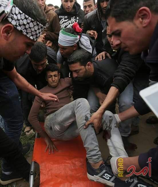 إصابة شاب برصاص جيش الاحتلال شرق غزة