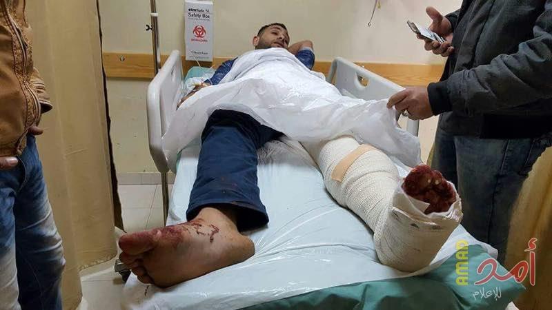 أمن حماس يطلق النار على الصحفي عاهد العبادي لرفضه اخلاء منزله قبل تجريفه (صور + فيديو)