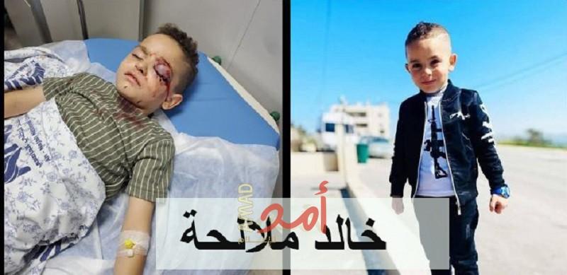 الحركة العالمية: جيش الاحتلال يتسبب بفقدان (3)  أطفال لأعينهم