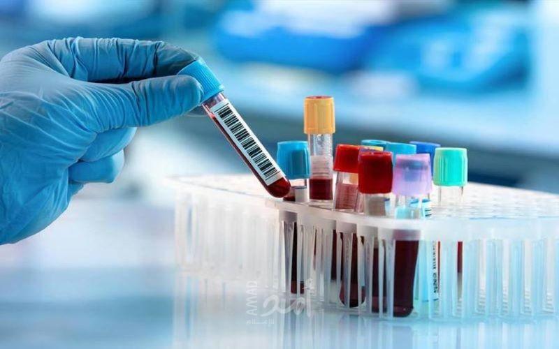 فحوص أساسية لإجرائها قبل الزواج وقبل الحمل خصوصاً