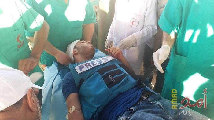 إصابة (4) صحفيين أثناء تغطيتهم جمعة "الحرية والحياة لغزة"