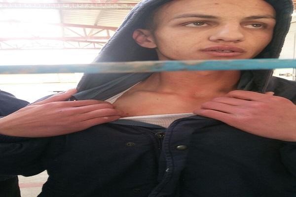 نادي الأسير يوثّق بالصور حالات الاعتداء على عدد من المعتقلين -صور