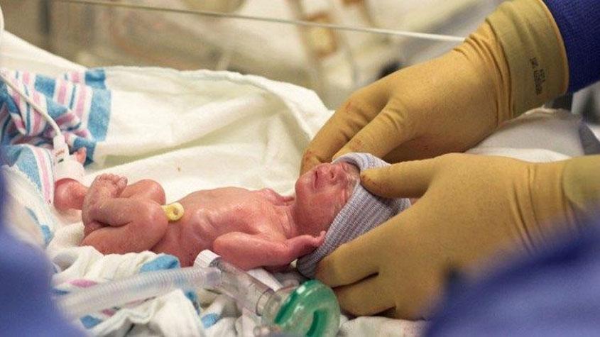 6 وفيات من "الخدج" في غزة منذ بداية العام