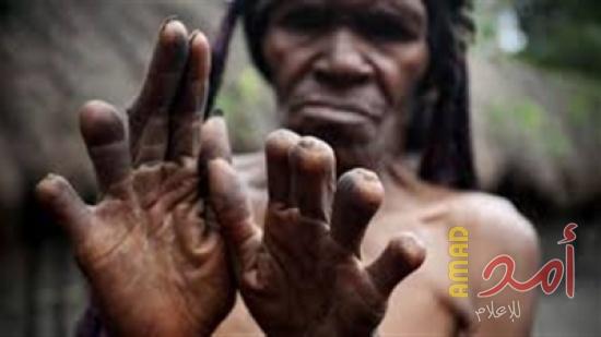 منها حظر دخول الحمام وقطع الأصابع.. أغرب 5 عادات حول العالم
