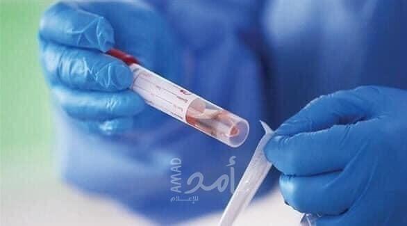 مصر .. تسجيل 17 حالة وفاة و178 إصابة جديدة بفيروس كورونا