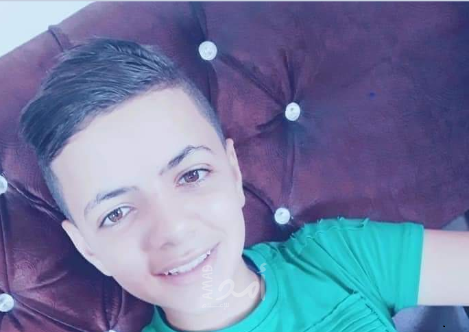 وفاة طفل من غزة بعد اشعال النار بنفسه