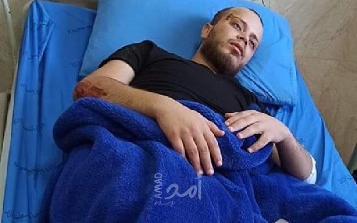 إصابة الشاب "مصطفى أبو سياج" دهساً من جيب لجيش الاحتلال في طوباس