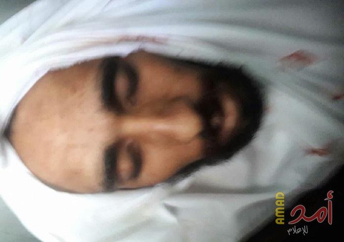 الشهيد الثامن في مليونية العودة هو "أحمد عوض الله"