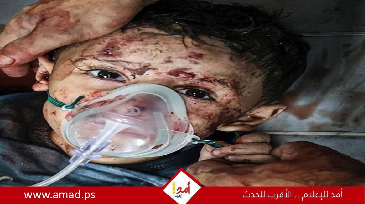 الطفولة الفلسطينية في مرمى نيران الاحتلال