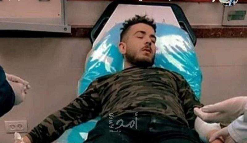 إصابة الشاب "يوسف قصراوي" برصاص جيش الاحتلال في طوباس