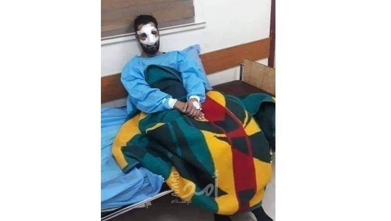 حقيقة إقدام زوجة على قطع أنف زوجها بسبب علاقاته مع فتيات.. بنابلس؟!