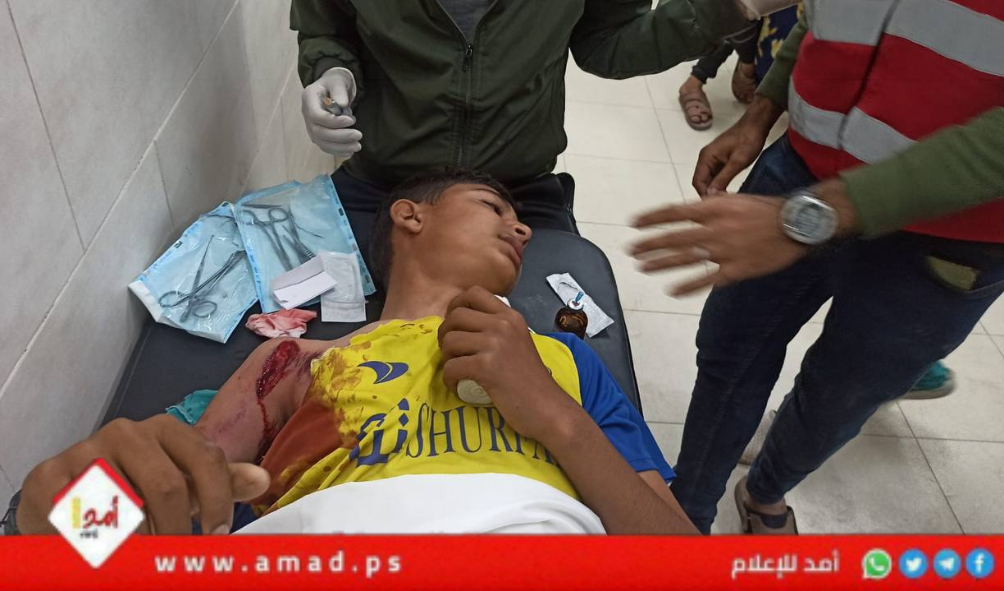 عشرات الشهداء والإصابات في قصف جيش العدو الفاشي المتواصل على قطاع غزة
