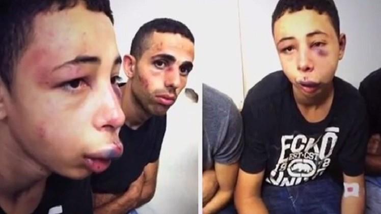 عائلة الشهيد أبو خضير تستعد لمقاضاة الاحتلال أمام الجنائية الدولية