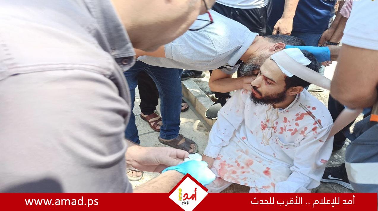 إصابة شاب بجراح اثر سقوط شجرة في باحات "المسجد الأقصى"