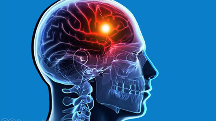 اسباب الإصابة بمرض التصلب المتعدد
