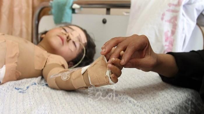 مؤسسة حقوقية ترصد ..غزة في اليوم العالمي للسرطان زيادة مطردة في عدد الحالات بنسبة من 10-15% سنويًا
