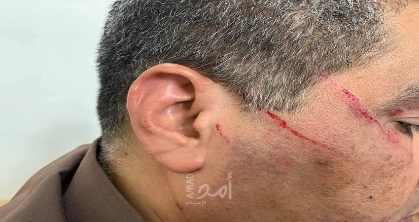 الطبيب "عوض" يكشف لـ"أمد" حيثيات اعتداء مواطن على أحد الأطباء في مستشفى الشفاء بغزة