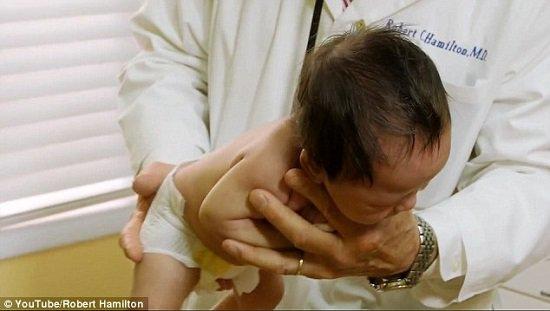 فيديو : حيلة من طبيب أطفال لإيقاف بكاء الرُضّع تحصل على مليوني مشاهدة عبر "يوتيوب"