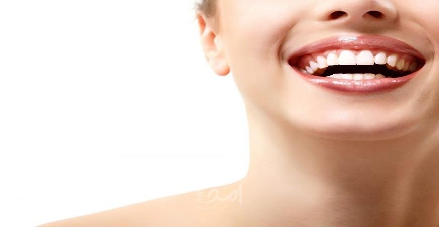 تعرف على المقاييس والمعايير الجديدة لاختيار "ابتسامة هوليوود"