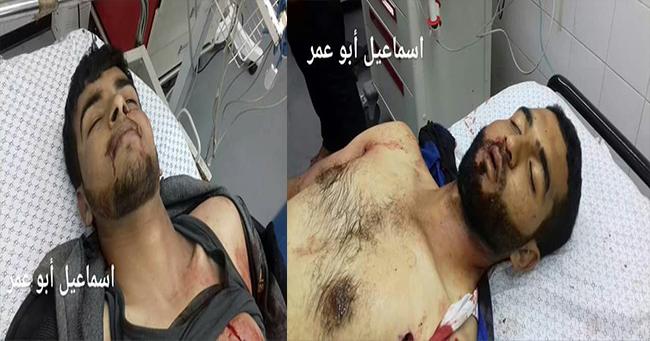 الصحة الفلسطينية: استشهاد شابين برصاص الاحتلال شرق خانيونس