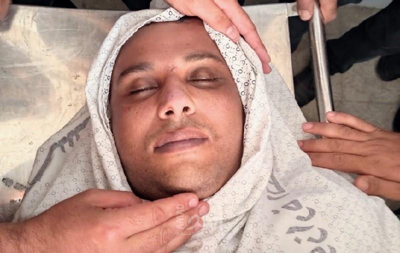 استشهاد "مؤيد حمدان" متأثراً بإصابته خلال العدوان على غزة