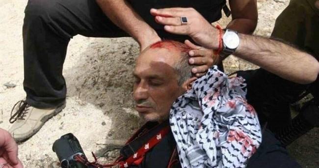 اصابة المصور الصحافي ناصر الشيوخي خلال تغطيه المواجهات في البالوع