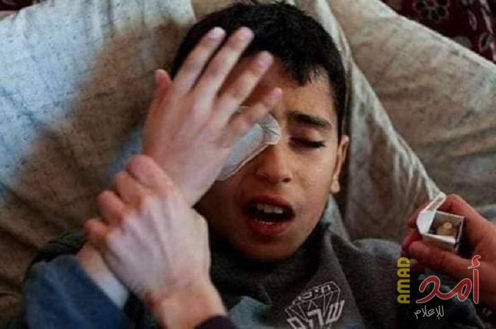 عائلة الجريح الطفل "محمد النجار" تناشد عباس ووزارة الصحة لإنقاذ حياته