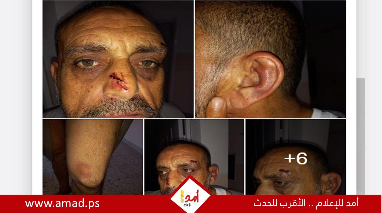 المواطن عاهد شمالي يناشد مؤسسات حقوقية للتحقيق فيما حدث - صور