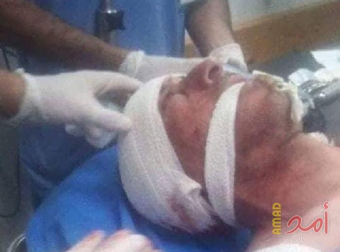 مقتل مواطن وإصابة 3 آخرين بينهم عناصر من أمن السلطة بالخليل