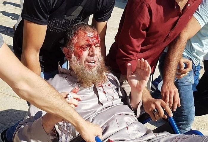 بالفيديو والصور.. إصابات بينها الشيخ "سلهب" باقتحام شرطة الاحتلال لساحات الأقصى