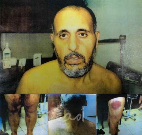 عدنان: الصور التي ظهر فيها التعذيب للأسرى في الجبهة الشعبية "مزلزلة"