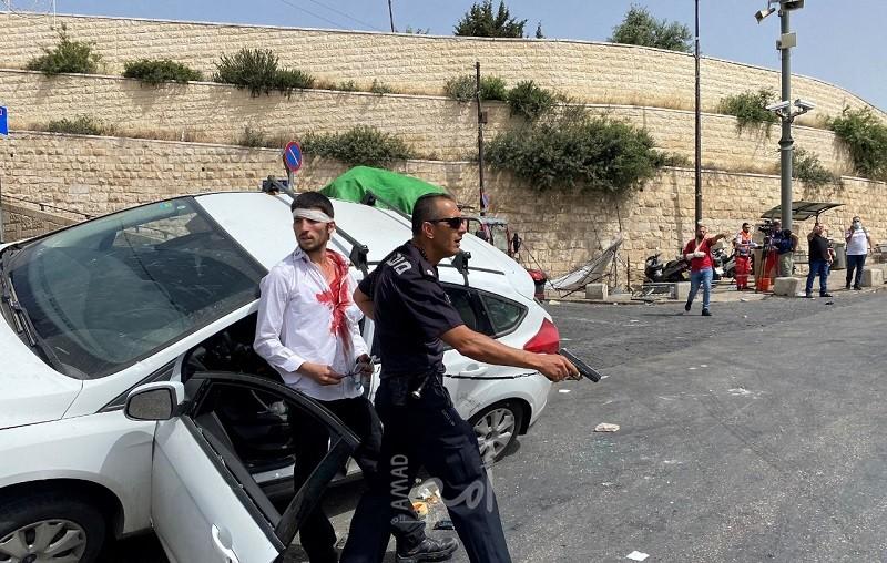 شرطة الاحتلال تحمي مستوطن دهس شاب فلسطيني وأصابه بكسور متعددة- فيديو