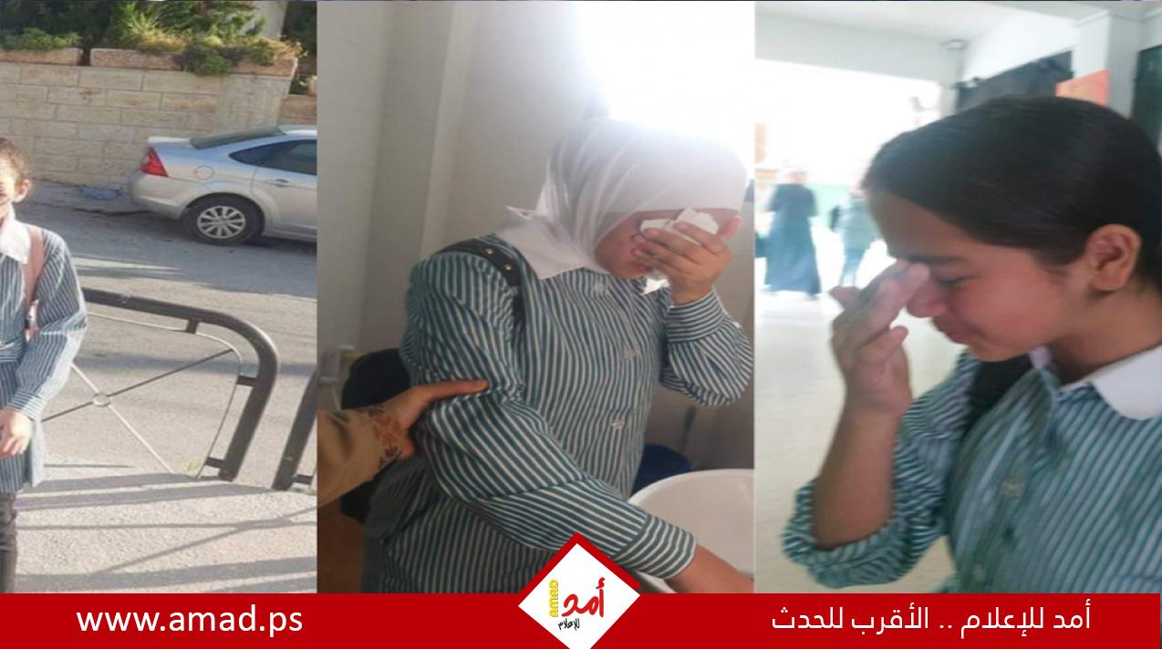 إصابة عشرات الطالبات بالاختناق إثر مهاجمة قوات الاحتلال لمدرسة في بيت أمر