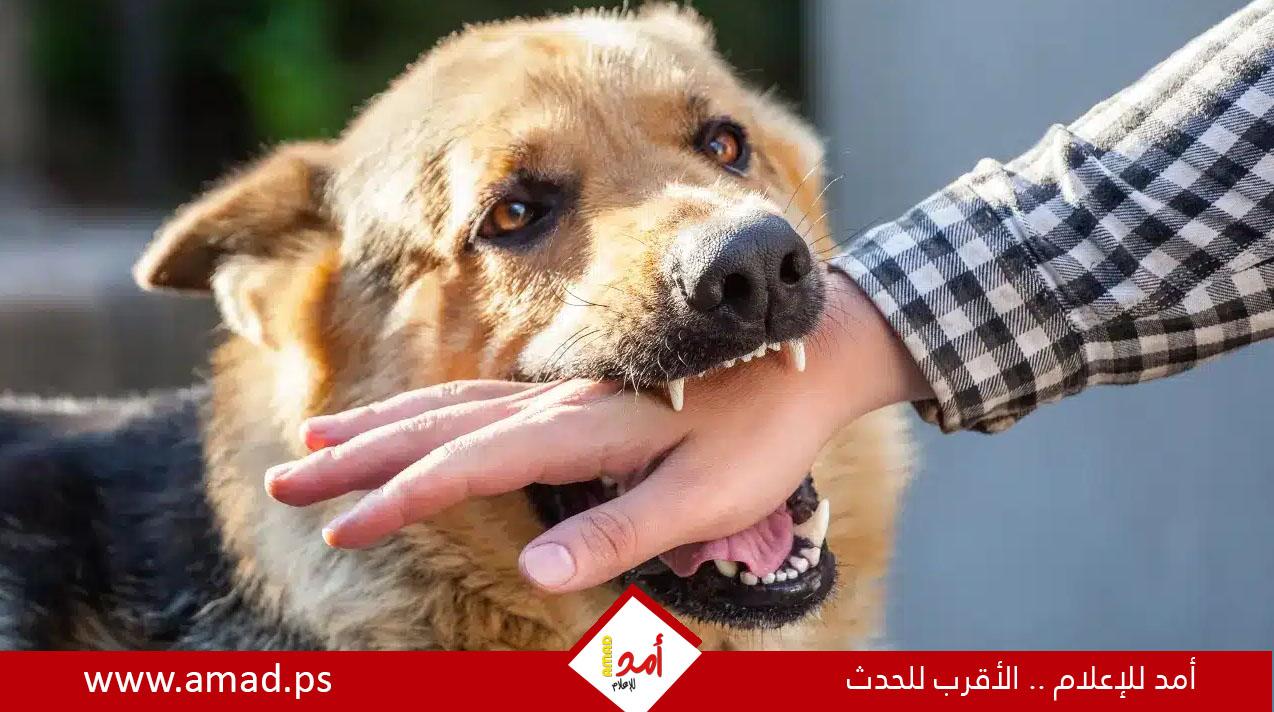 ماذا تفعل إذا تعرض طفلك لعضة أو خدش من كلب؟
