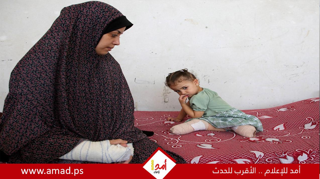 الصحة: غزة تسجّل أعلى معدل لبتر الأطراف لدى الأطفال نسبةً لعدد السكان عالمياً