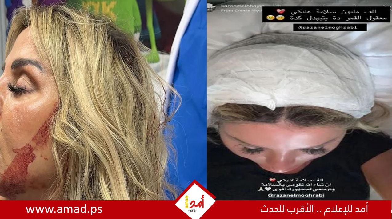 رزان مغربي تطمئن جمهورها بعد إصابة الرأس